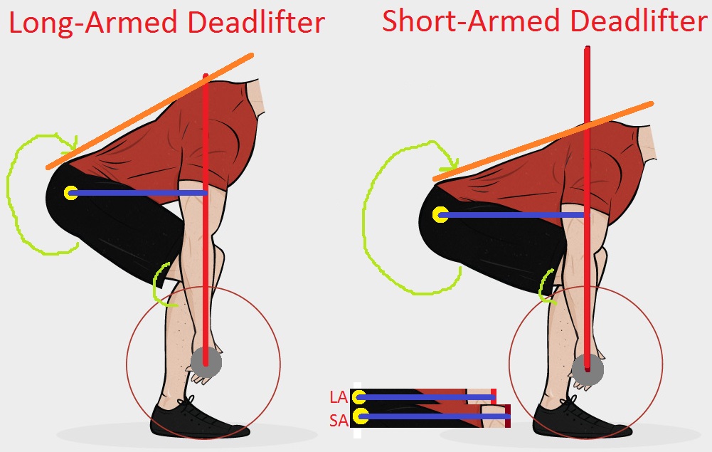 Comparison between the conventional and sumo deadlift.*